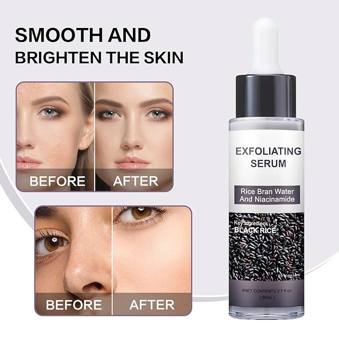 Peel Shot Glow Rice Ampoule Duo – Peel Shot Serums with White & Black Rice Extract, BHA, Niacinamide & Hyaluronic Acid – Exfoliating, Brightening, Moisturizing, Blackhead Remover & Pore Refining