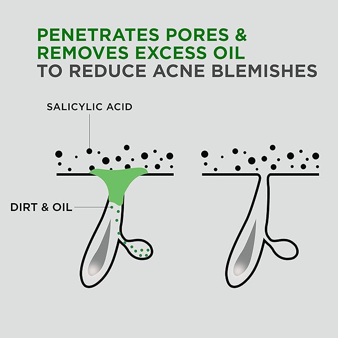 DOVE MEN + CARE Advanced Care Cleanser Acne Clear 3 Count for Acne Prone Skin Face + Body Cleanser with 1% Salicylic Acid 16.9 oz