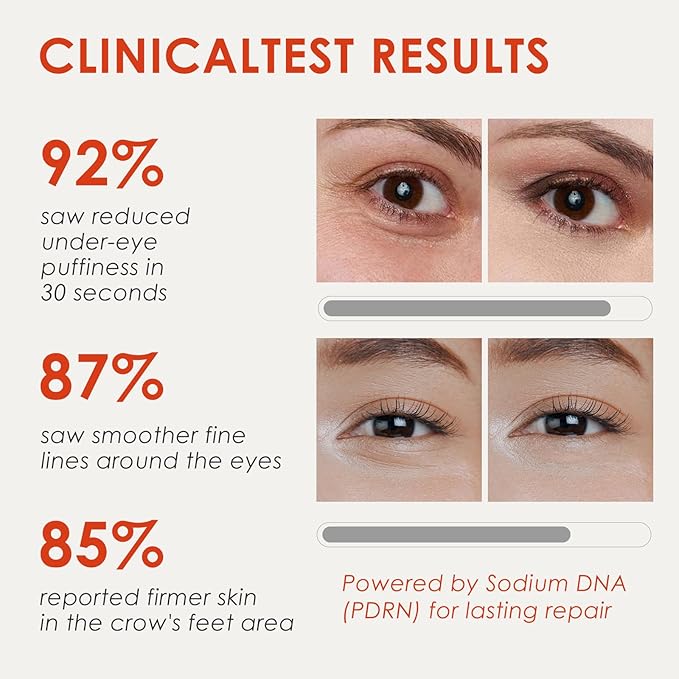 30S Instant Eye Lift Cream | Temporary Eye Tightener | Smooths Wrinkles, Puffy Eyes & Eye Bags | Dual-Action Firming | PDRN Formula for Long-Term Repair, Korean Skincare, 0.71 Fl Oz