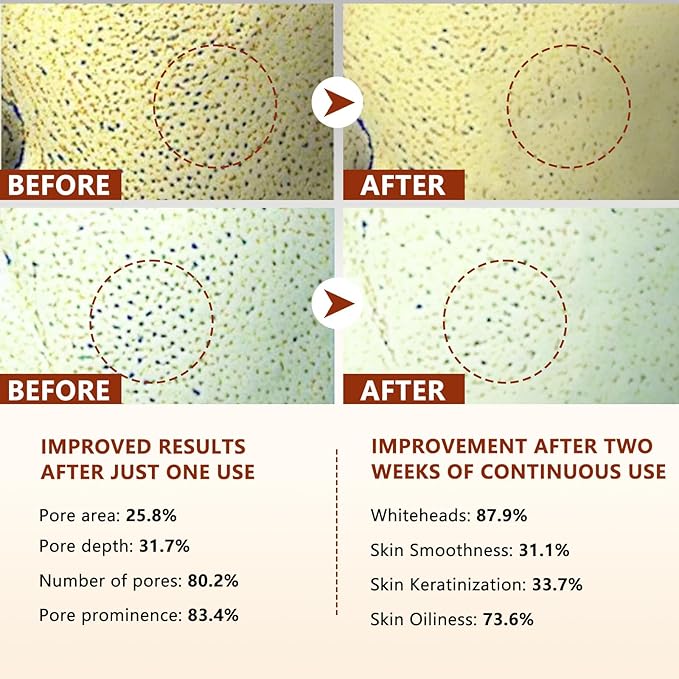 Rice Peel Shot, Peel Shot Glow Rice Ampoule Duo, Gently Exfoliates, Removes Dead Skin and Blackheads, Says Goodbye to Roughness and Dullness, and Makes Your Skin Glow 160 ML 2.7 Fl Oz (Pack of 2)