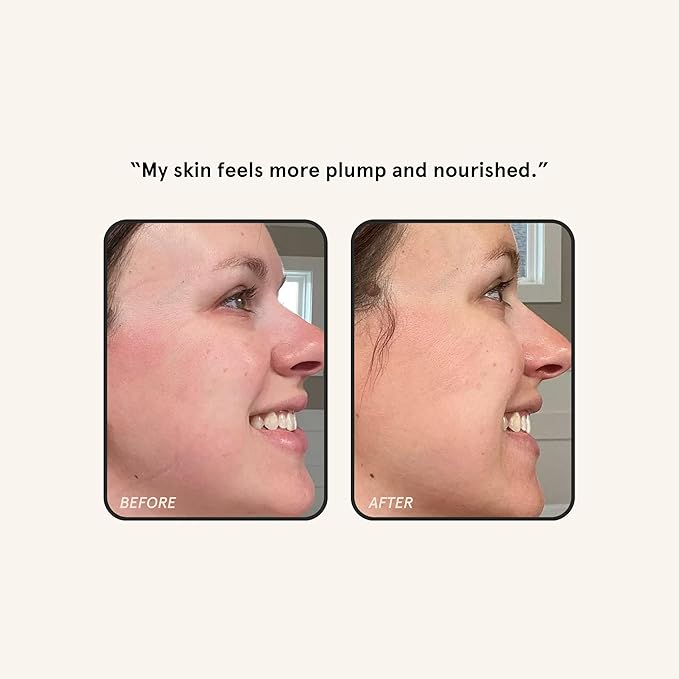 Barefaced Bright Skin Routine - Toning Pads, Brightening Serum, Liquid Gold, & Hydrating Lotion for Smoother, Brighter Skin