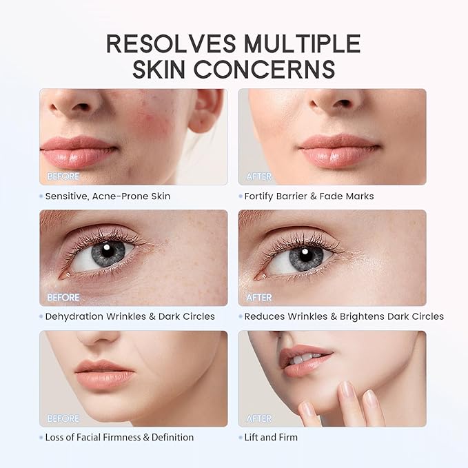 LULUROSE 4-in-1 Facial Massager,Cold Heat Facial Beauty Device for Face Neck Eye Lifting Firming Depuffing,Facial Sculptor Skin Care,at Home or Traveling