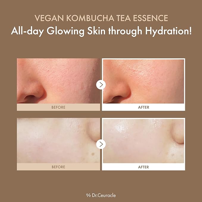 Dr.Ceuracle Vegan Kombucha Tea Essence - Hydrating Milky Toner with Kombucha Tea Extract, Centella Asiatica, Ceramide, Korean Skincare Essence (150 ml / 5.07 fl. oz.)
