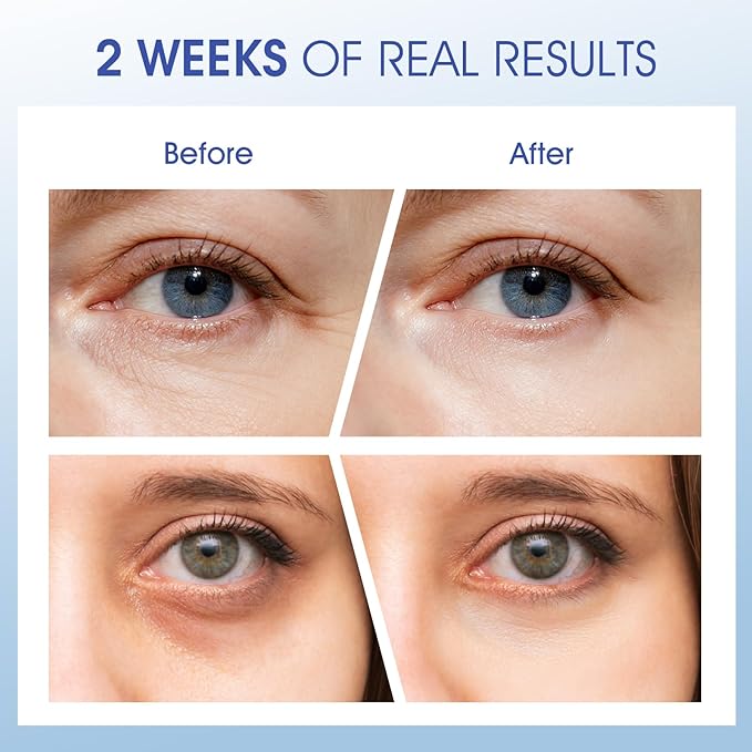 Eye Cream for Wrinkles, Fine Lines & Crows Feet - With Ceramides, Peptides + Caffeine + Niacinamide - Anti Aging Skin Renewing Under Eye Cream for Men and Women, 0.5 Oz