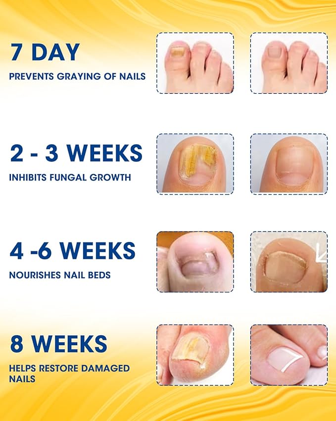 Nail Repair Patches Extra Strength,