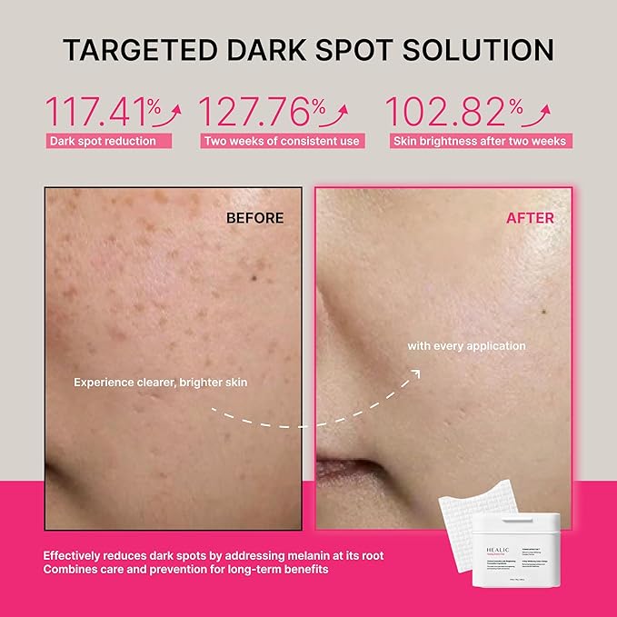 Toning Active Pad – Dual-Textured Toner Pads for Brightening, Hydrating, and Soothing with Tranexamic Acid & Hyaluronic Acid – Gentle for Sensitive Skin, Korean Skin Care, Vegan, 70 Pads