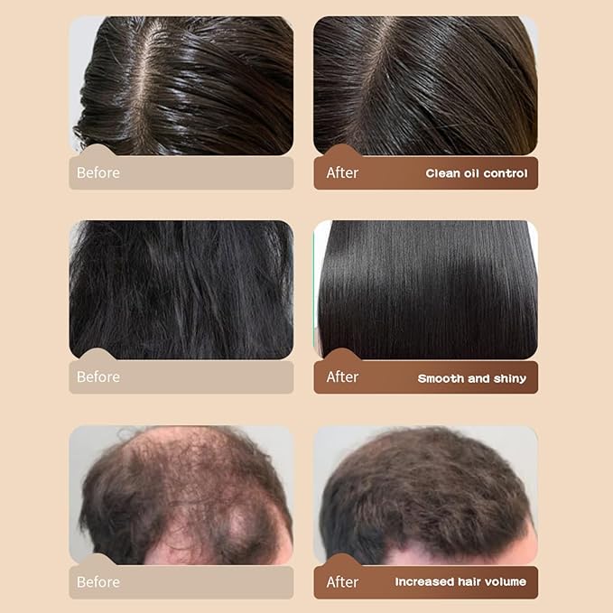 Silvercell Castor Oil for Hair Growth Conditioner, Prevents Hair Loss Conditioner Strengthens Hair Roots, Hair Care Conditioner Nourishes Dry Hair, Hair Thickening for Women & Men,16.91 fl.oz