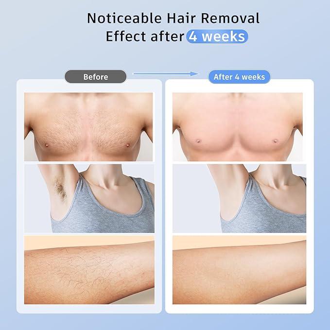 Laser Hair Removal Ubroo IPL Hair Removal Device with 5℃ Ice Cooling, 3 In 1 Painless Hair Removal For Women Men Permanent Face Body Beauty Care (Gold)