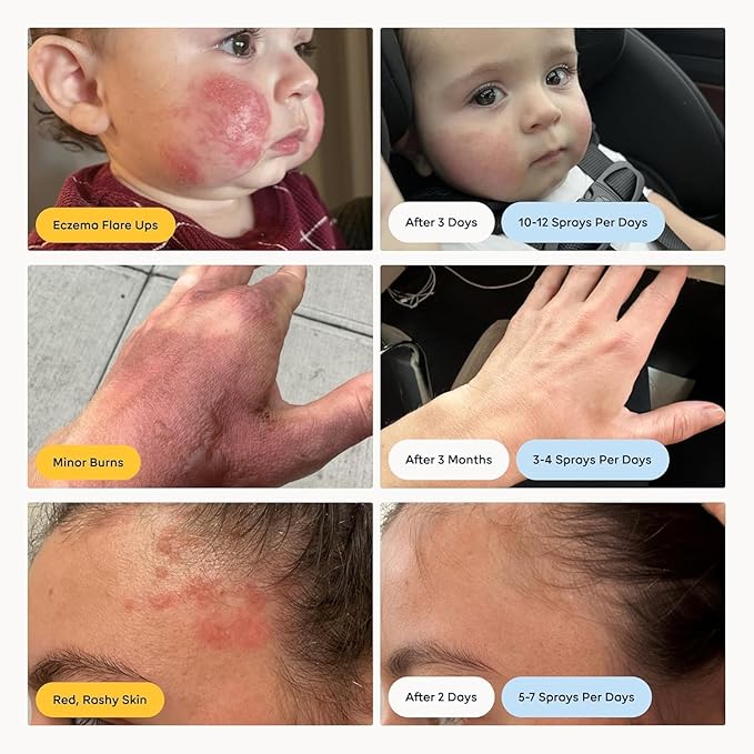 Magic Molecule Hypochlorous Acid Spray – Soothing Facial Mist for Redness & Irritated Skin – Cleansing & Purifying – Everything Home & Travel Bundle (1x 8oz + 2x 3.4oz)