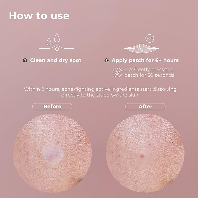 OMMA 72 Patches Pimple Patches for Face and 18 Micropoint Acne Patch Bundle