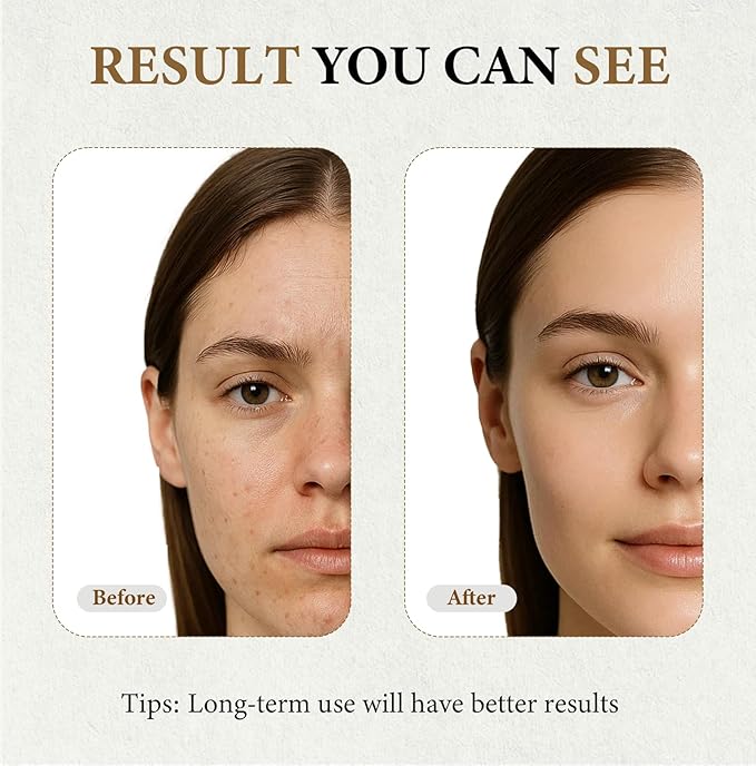 Black and White Rice Peeling Ampoule Duo, Soft Exfoliating Face & Body, Peel Shot Glow Scrub, Remove Dead Skin Cells, Blackheads and Pore Minimizing Serum, Hydrating Formula Serum for All Skin Types