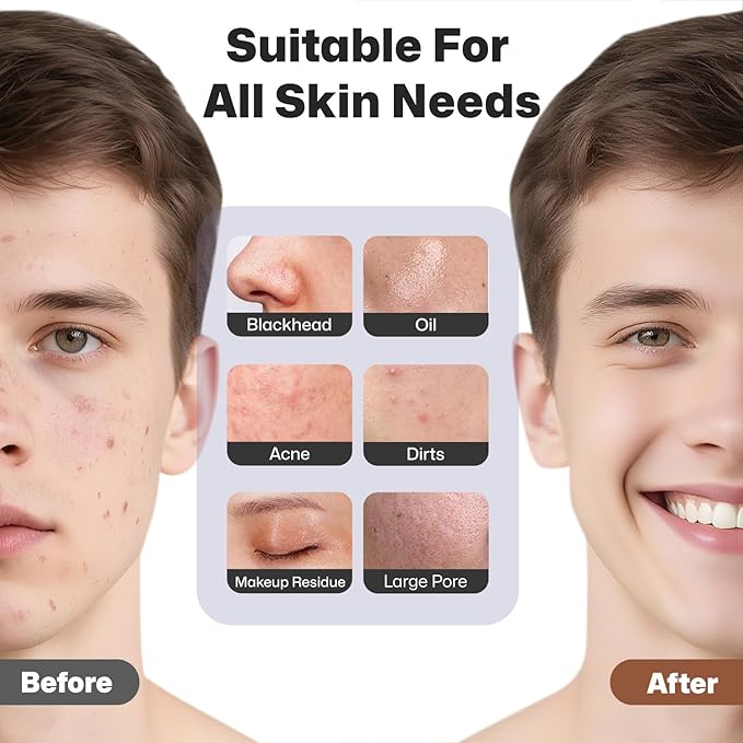 PRITECH Facial Cleansing Brush, Rechargeable Silicone Face Scrubber with Heat Massage End, Vibrating Exfoliator Scrubber for Deep Cleaning, Waterproof Face Brush for Women and Men (Black)