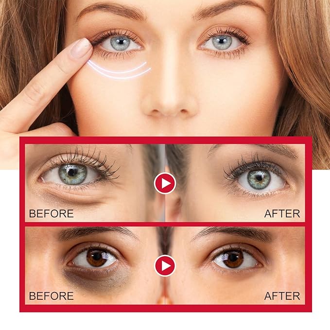 Retinol eye stick, retinol eye