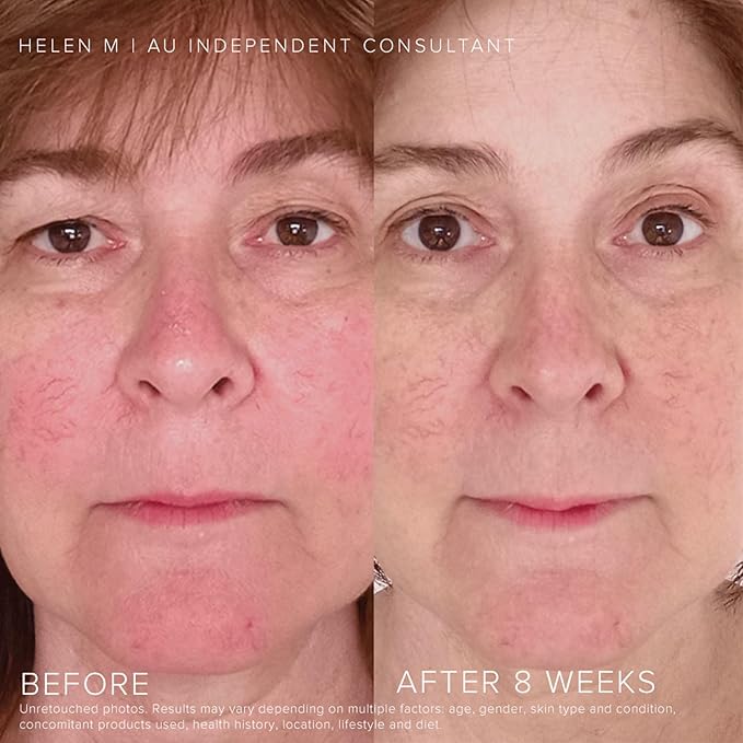Rodan and Fields Soothe Regimen for Sensitive, Irritated Skin and Facial Redness