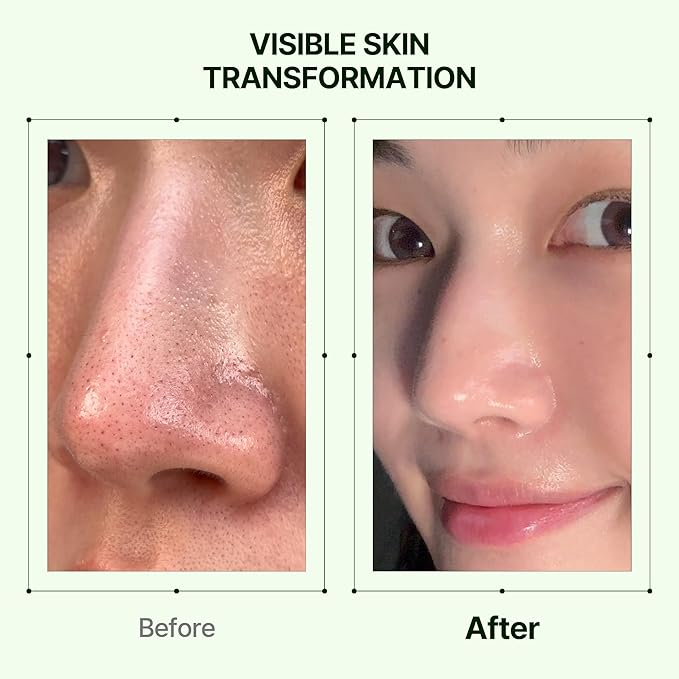 Mugwort Zero Film Cleansing Oil 6.76 fl.oz. 200ml ㅣDaily Makeup Blackhead Removal No pore clogging Korean skincare double cleansing