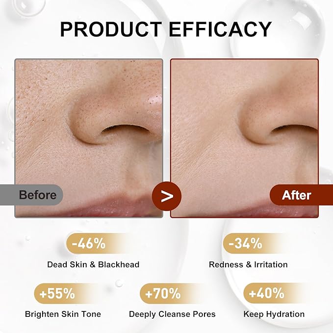 Peel Shot Glow Black Rice & Niacinamide Exfoliating Ampoule - Soft Peel for Face & Body to Visibly Refine Pores, Brighten Skin, Deep Pore Cleansing - For All Skin Types, 2.71 Fl Oz