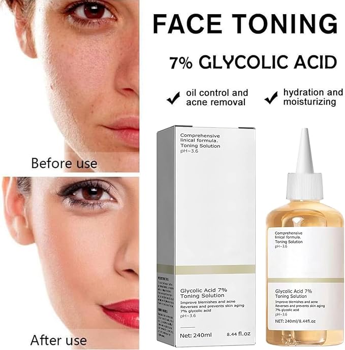 Glycolic Acid Toning Solution, Glycolic Acid 7% Toner, Glycolic Sour 7% Toning, KeepThe Skin Moist, Exfoliating Serum for Face, Facial Exfoliation Astringe Pores (240ML/8.0 Fl Oz)