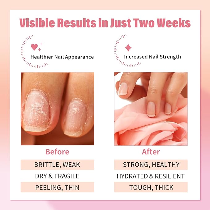 EJW Nail Strengthener Serum -