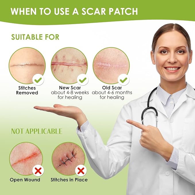 AUSLKA Silicone Scar Sheets(1.6"x 120" Roll-3M),