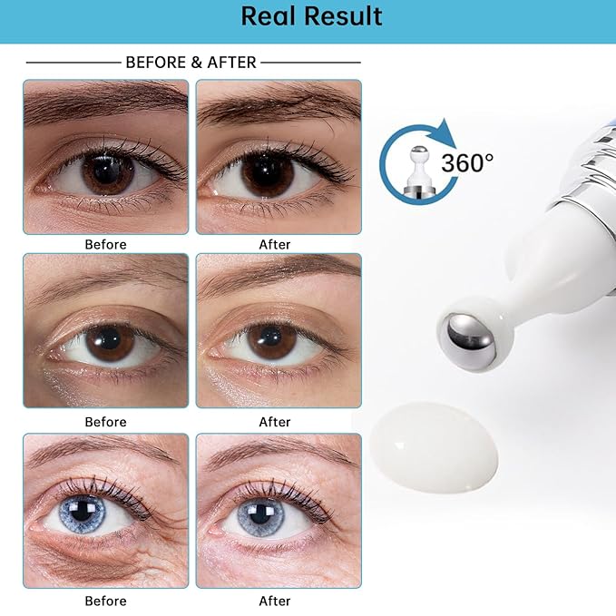 5% caffeine eye cream anti