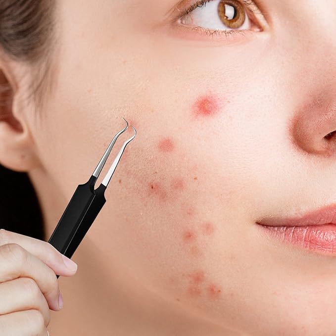 Honoson 3 Pcs Blackhead Tweezer Stainless Steel Pimple Tweezers Extractor Tool for Remove Zit Whitehead Pimple Bend Curved Tweezer Skin Blackhead Remover Tools(Black)