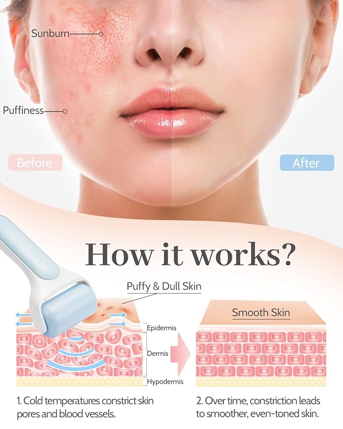 MORGLES Ice Roller for Face, Premium Facial Roller for Puffiness, Dark Circles and Lymphatic Drainage, Cold Face Roller for Women Self Care with Carry Case