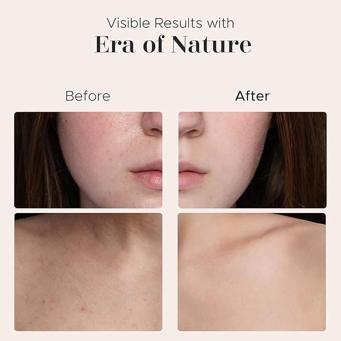 era of nature Mango Whipped Body Cream for Women 16oz - Lightweight Whipped Lotion with Pure Mango - Non-Greasy Body Butter Cream Lotion & Balm Moisturizer for Face, Hair & Dry Skin, Vegan Skincare