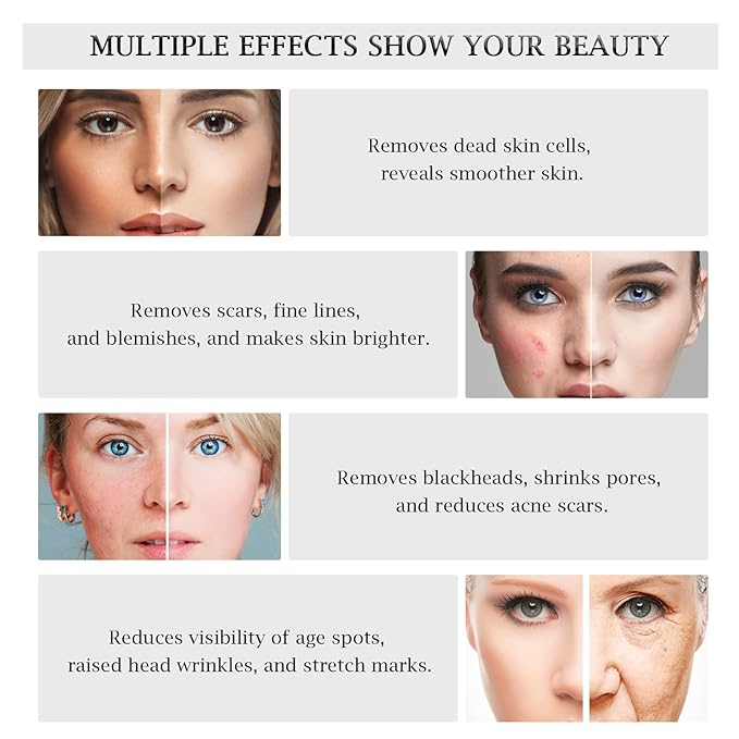 3 in 1 Diamond Microdermabrasion Machine, Professional Microdermabrasion Device with Vacuum Spray, Beauty Facial Skin Care Dermabrasion Equipment for Salon Personal Home Use