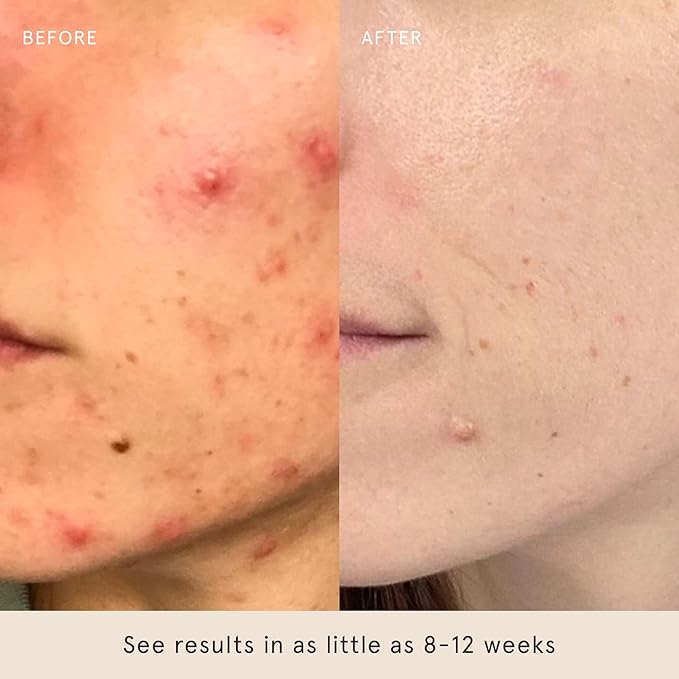 Barefaced Core Four - Toning Pads II, Liquid Gold, RetinAL Skin Therapy, Tinted SPF