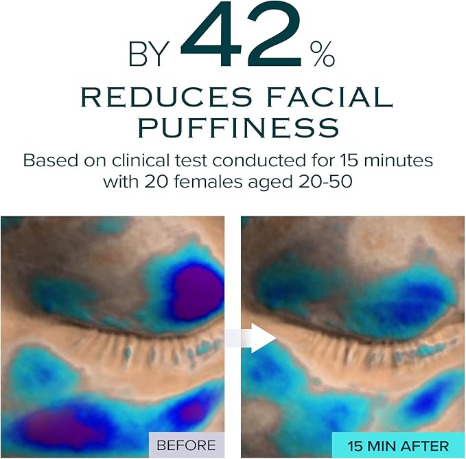 Ice Sorbet Toner Pads | Skin Prep Wipes for Puffiness, Under Eye Bags & Instant Face Lift | Gel Pads for Sunburn Relief & After Sun with 30% Glacial Water & Caffeine | 7.43 Fl Oz / 60 Count