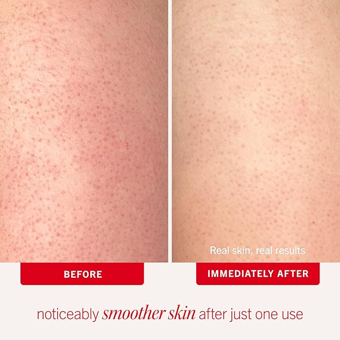 First Aid Beauty Smooth + Juicy Body Scrub Kit: KP Bump Eraser Body Scrub with 10% AHA, Daily Exfoliation Keratosis Pilaris Set to Help Reduce Chicken Skin Bumps; Strawberry, Peach, & Original (2 oz)