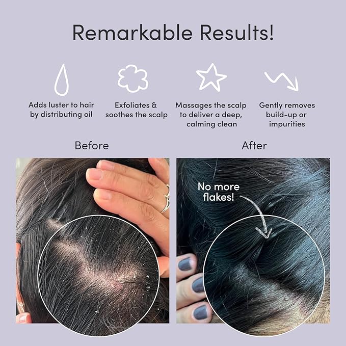 Jupiter Exfoliator Brush For Removing Dandruff & Build-Up - Detangling Scrubber For Wet or Dry Hair - Supports Circulation & Growth - For All Hair Types - Black