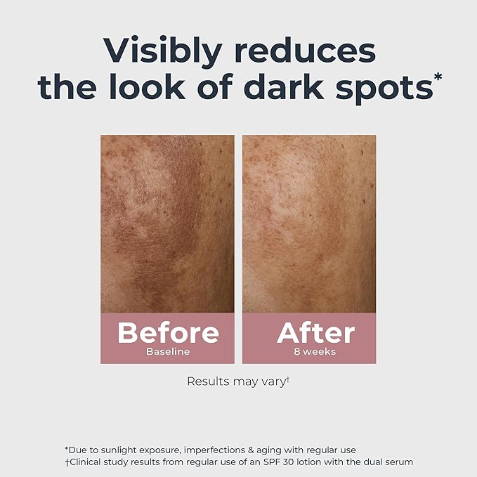 Eucerin Radiant Tone Dual Serum Dark Spot Corrector, Dark Spot Serum with Thiamidol and Hyaluronic Acid, Helps Visibly Reduce the Look of Persistent Dark Spots, 1 Fl Oz Bottle