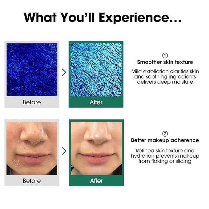 SOME BY MI AHA BHA PHA 30 Days Miracle Toner – 5.07oz, 150ml – Korean Salicylic Acid Exfoliating Face Toner for All Skin Types – Daily Pore Care & Oil Control with 2% Niacinamide – Korean Skin Care