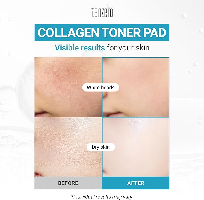 TENZERO Moisture Collagen Toner Pad (70 Count, 160g), 100% Natural Cotton, Hydrating Moisturizing Glowing Face Toner Pads, Gentle Exfoliate & Improve Elasticity, Korean Facial Toner, Dry & Dull Skin