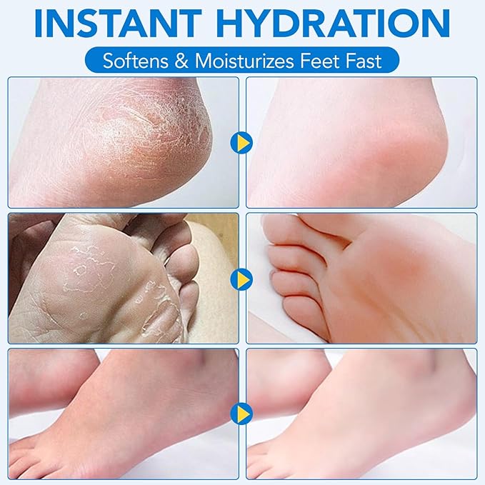 Urea Cream 60% plus Salicylic Acid 2% Urea Foot Care Stick, Foot Cream for Foot Callus Remover, Feet Moisturizer Stick for Dry Cracked Heels, Hands, Knees, Hydrating Heel Balm, Easy To Use
