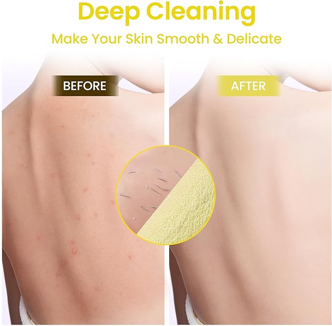 3 Pcs Double-Sided Back Exfoliator Body Scrub Towel, Exfoliating Back Scrubber with Handles,Exfoliating Washcloth Bath Tool in Shower, Stretchable Back Washer to Deep Cleans Skin (Beige)