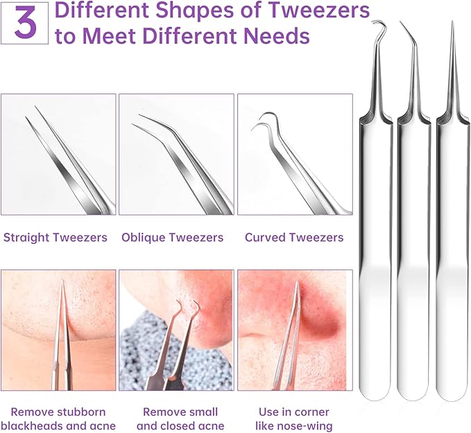 15 PCS Pimple Popper Tool Kit,Blackhead Remover Comedone Extractor Tools,Professional Pimple Comedone Extractor,Stainless Steel Skin Blemish Removal Acne Tools for Forehead Nose Face with Metal Case