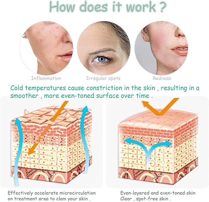 Ice Roller for Face,Cold Facial Massager for Eye Puffiness,Skin Care Tools for Migraine Relief and Blood Circulation (Green)