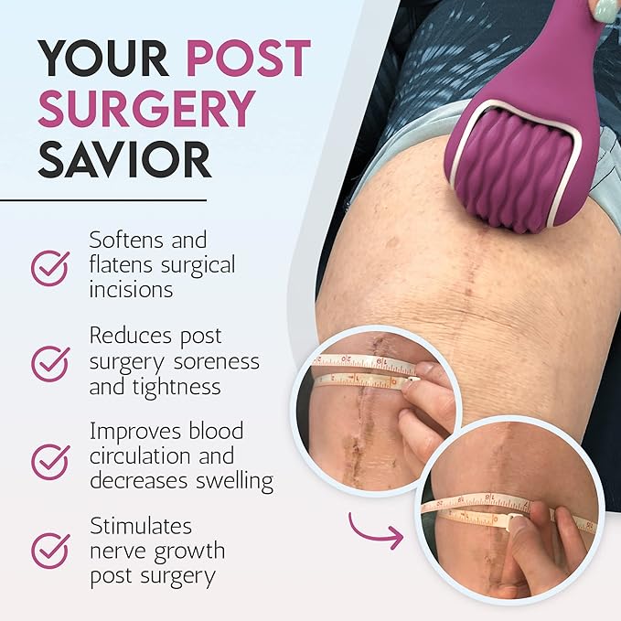 Scar Roller, Scar Tissue Massager for Post-Surgery Recovery, Silicone Ice Massage for Post-Surgery Incision Swelling and Soreness, Joint Roller for Improved Range of Motion and Flexibility. Purple