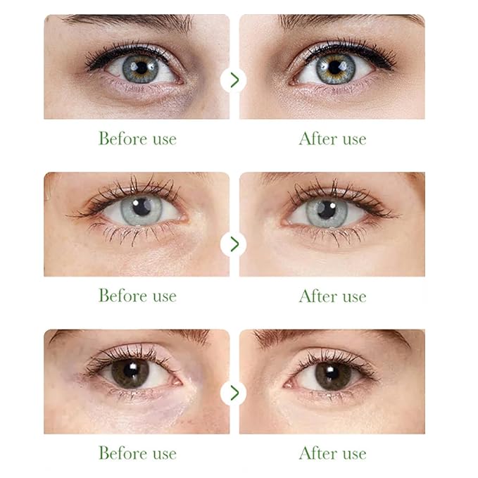 Aloe Vera Under Eye Mask,60 PCS Aloe Vera Gel Eye Mask Skin Care,Hyaluronic Acid Collagen Under Eye Patches for Dark Circles and Puffiness,Reduce Wrinkle Patches,Improves & Firms Eye Skin