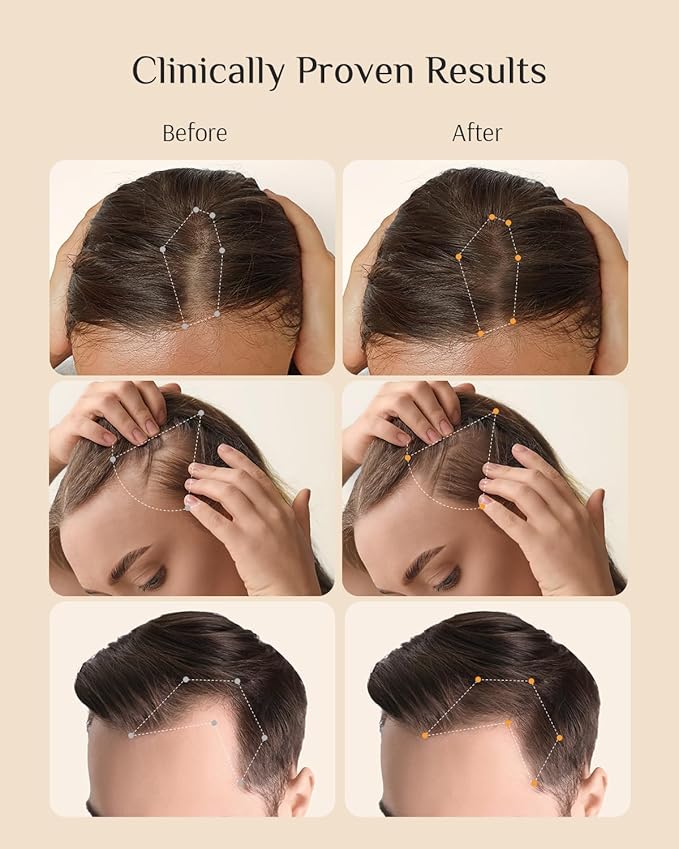 DR ZERO 3% Redensyl Hair Growth Serum for Women, Hair Scalp Serum Spray for Hair Loss and Regrowth, Clinically Tested for Hair Thinning Therapy and Scalp Care, Japanese Hair Treatment, 60ml