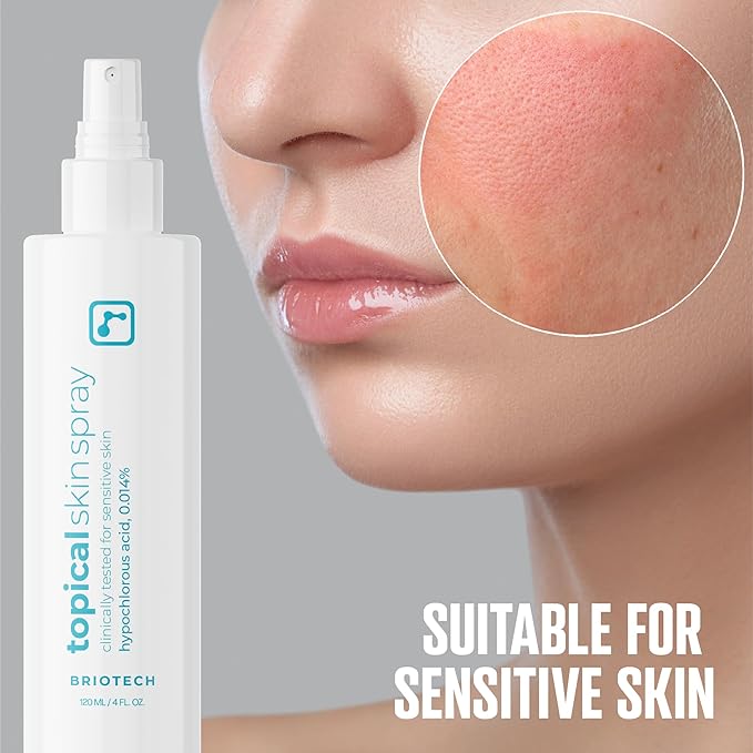 BRIOTECH Topical Skin Spray, Hypochlorous Acid Spray for Sensitive Skin, HOCl Facial Mist, Full Body Support Against Irritation, Calm Redness, Soothe Foot & Scalp, 8 oz (1 Pack)