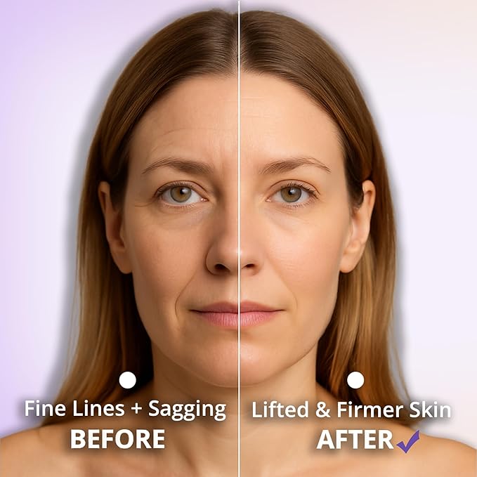 5-in-1 Microcurrent Facial Device for Face Tightening, Lifting & Wrinkle Reduction – Non-Invasive Anti Aging Tool, Jawline Shaper & Skin Lifting Face Sculpting Device for At-Home Skincare