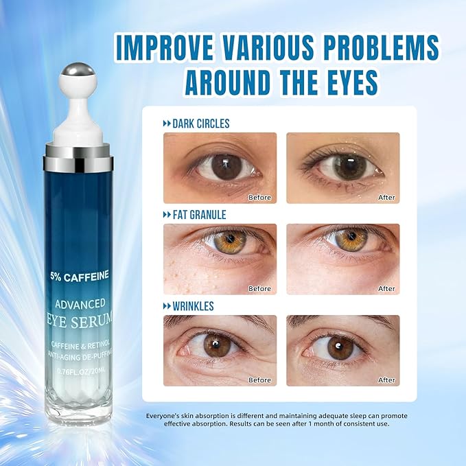 5% Caffeine Eye Cream & Under Eye Serum for Dark Circles and Wrinkles, Under Bags Treatment, Anti-Aging Caffeine Serum with Hyaluronic Acid and Niacinamide, 360° Roller Massage(20ML)