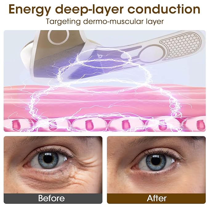 Eye Anti-wrinkle and wrinkle removal Device, Eye Patches with Hydrocolloids Collagen gel, for Dark Circles, Wrinkles & Puffiness & Smile lines