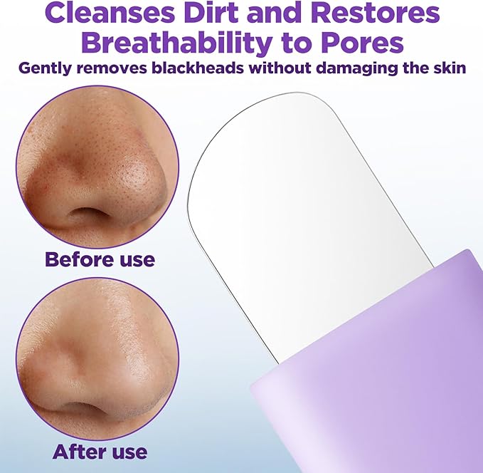 Face Scrubber Pore Cleaning Brush Face Mask Applicator Skin Care Tool for Men Women Deep Cleansing(Purple)