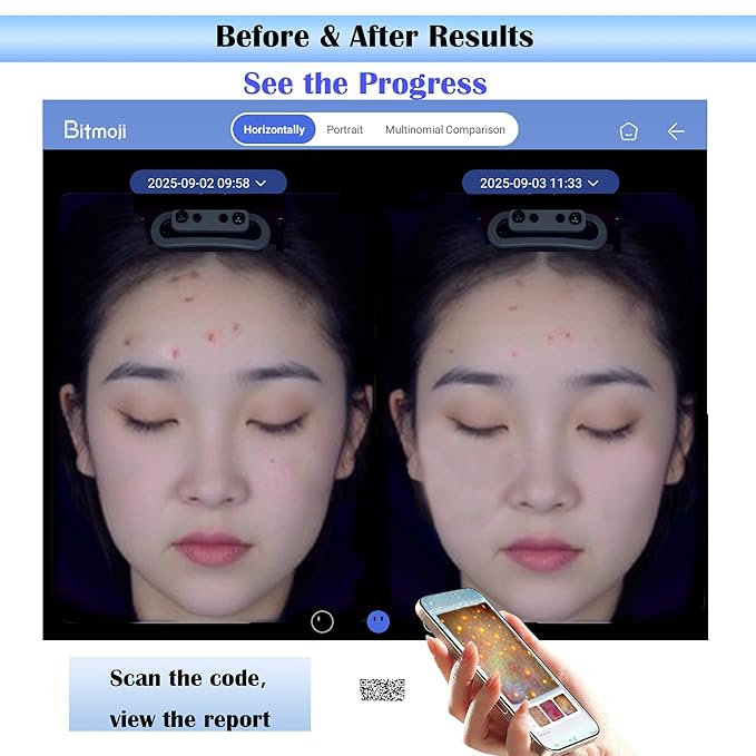 Skin Analysis Machine Professional Facial: 15.6'' HD Touchscreen, w/8-Spectrum Imaging, Before&After Comparison, AI Product Recommendation – Ideal for for Salons, Spas&Skincare Studios