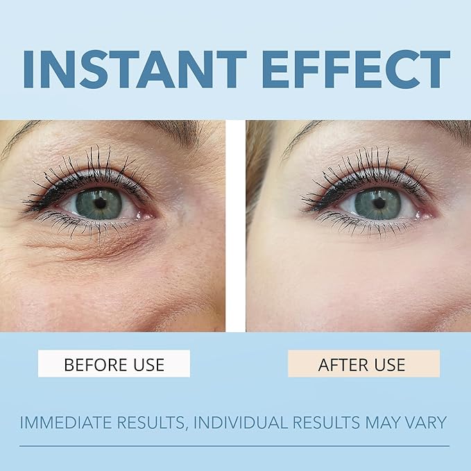 Instant Firming Eye Serum - Instantly Visibly Reduces Under Eye Bags and Wrinkles, Fine Lines, Crow's Feet, and Dark Circles,Anti Aging Wrinkle Remover for Face with Pump, 10ml/0.34 Oz