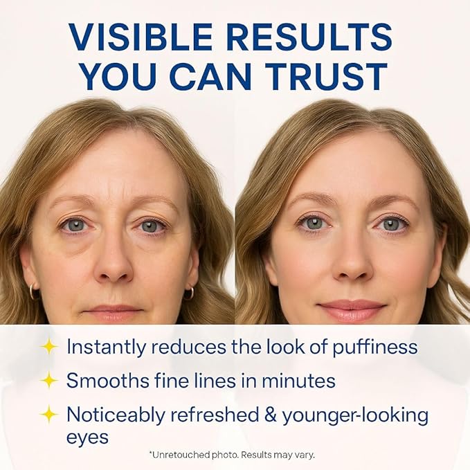 Instant Under Eye Lift Serum,Advanced Reduces Eye Bags, Wrinkles, Puffy Eyes, Dark Circles and Crow’s Feet-Revive Eyes Serum for Mature Skin - 20ml/0.68 fl oz